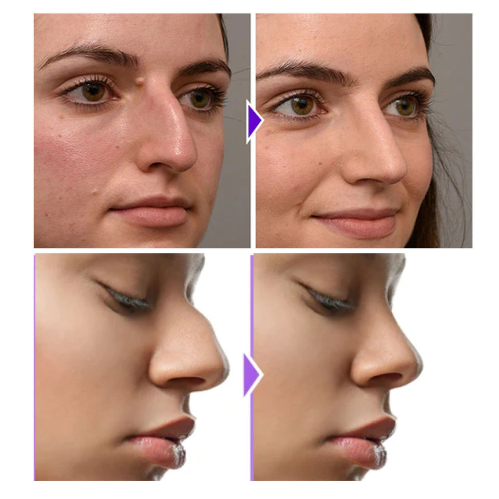 EELHOE Nose Shaping Tool for Defined Contours