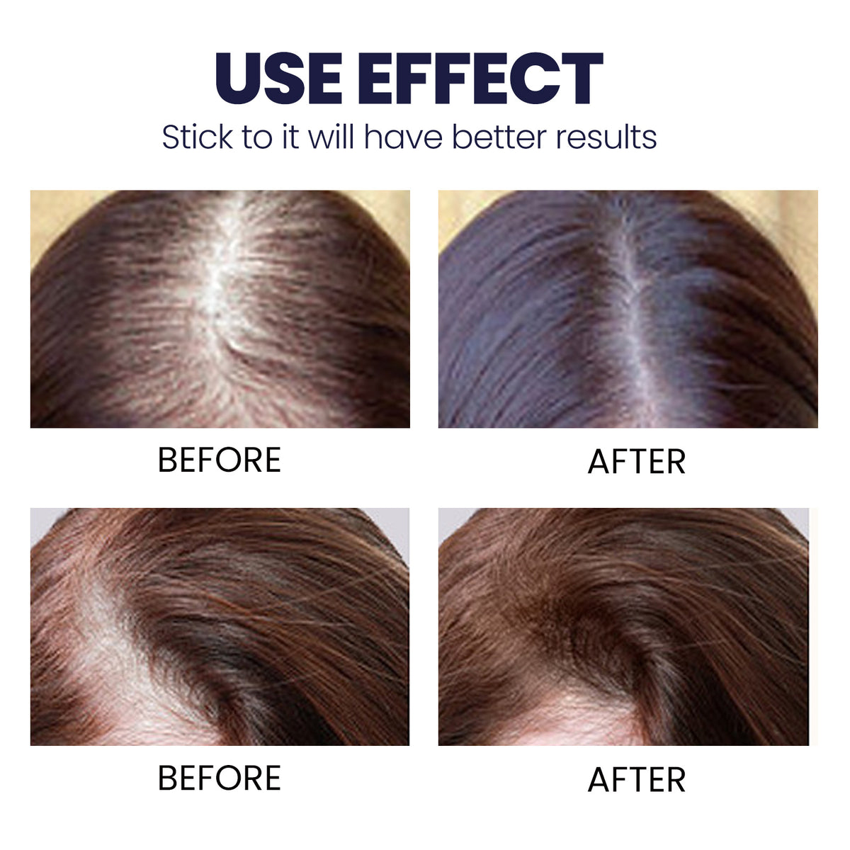 OUHOE Strong Hold Hair Spray for Damaged Hair Repair