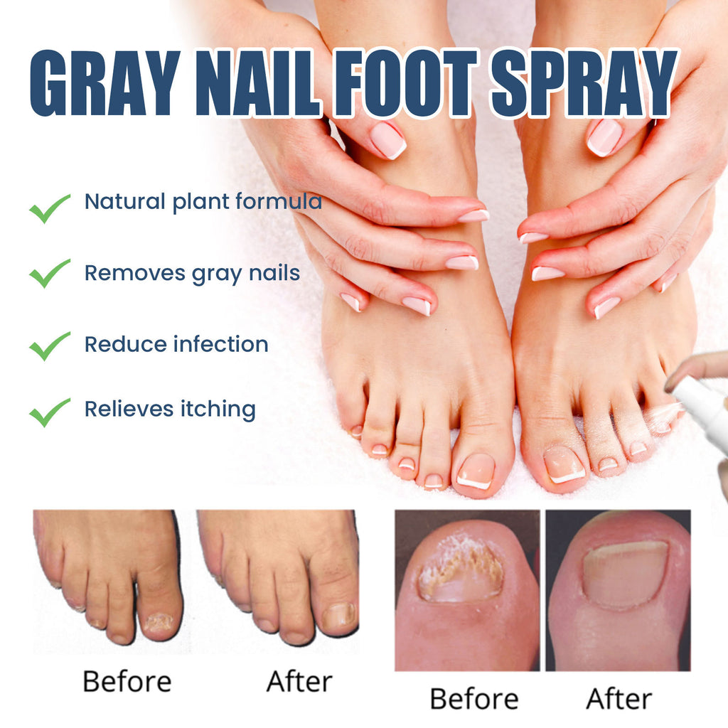 South Moon Nail Repair Spray for Moisturizing Care