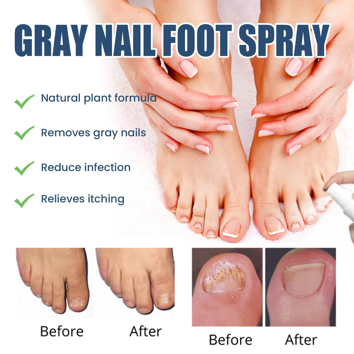 South Moon Nail Repair Spray for Moisturizing Care