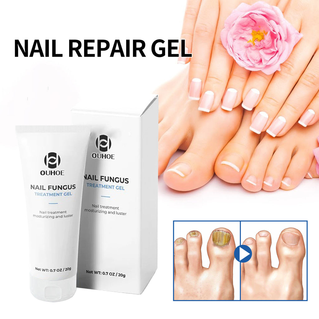 OUHOE Nail Care Gel for Thickening and Repairing Nails