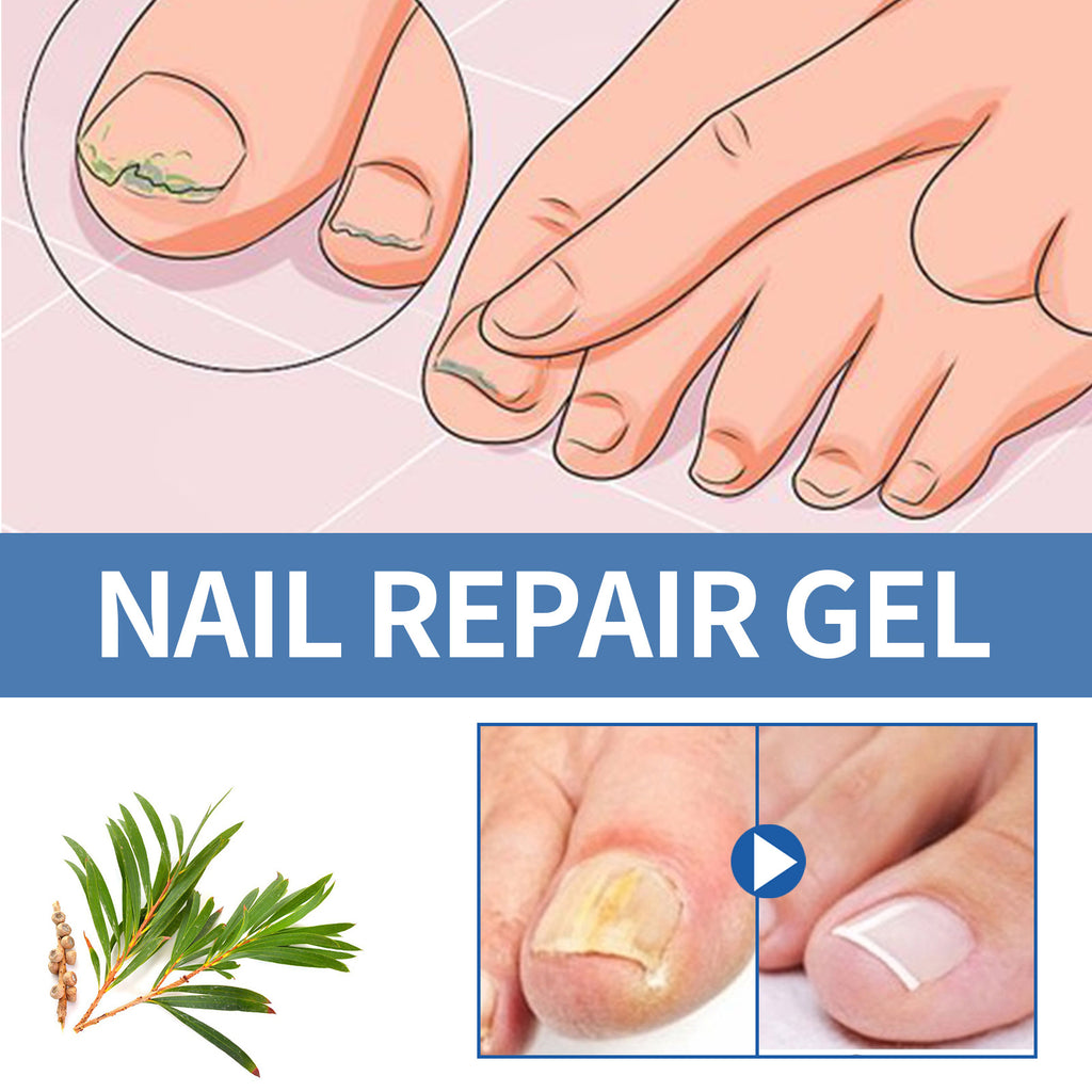 OUHOE Nail Care Gel for Thickening and Repairing Nails
